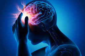 Migraines