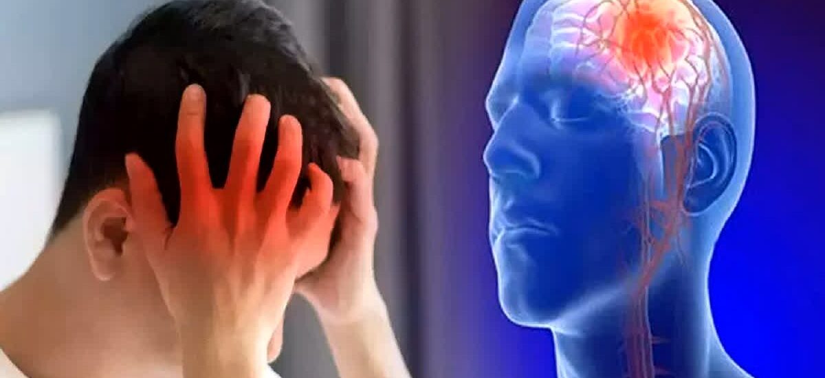 brain stroke