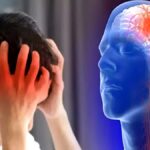 brain stroke