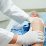 knee replacement