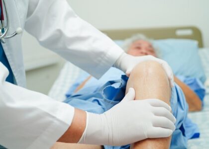 knee replacement