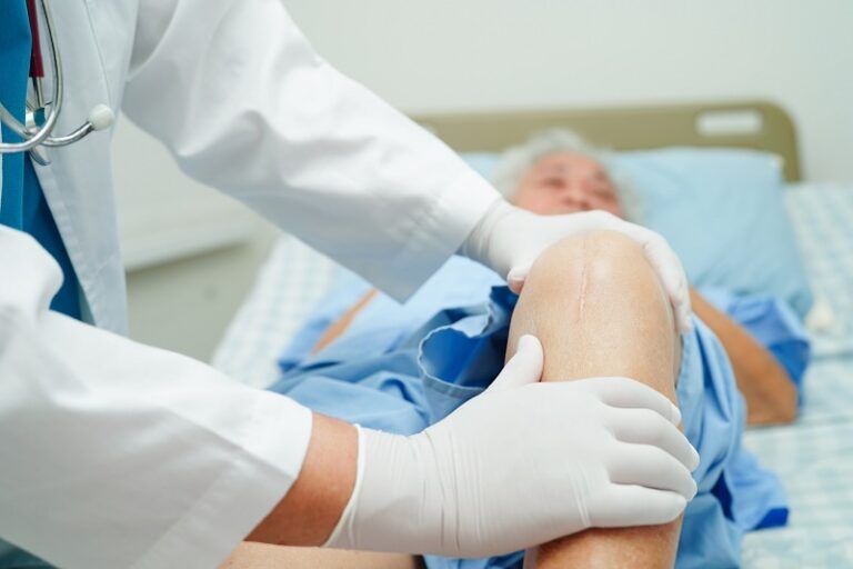 4 Symptoms That Indicate It’s Time for Knee Replacement Surgery